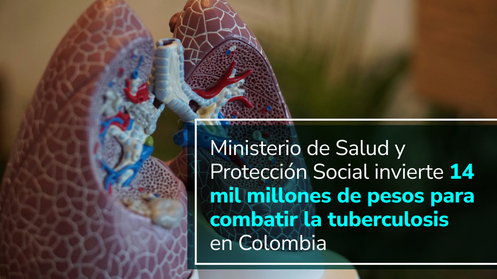 Modelo anatómico de pulmones humanos con una sección abierta que muestra la estructura interna, incluyendo la tráquea, bronquios