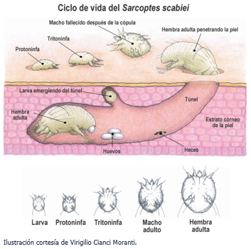 escabiosis.png