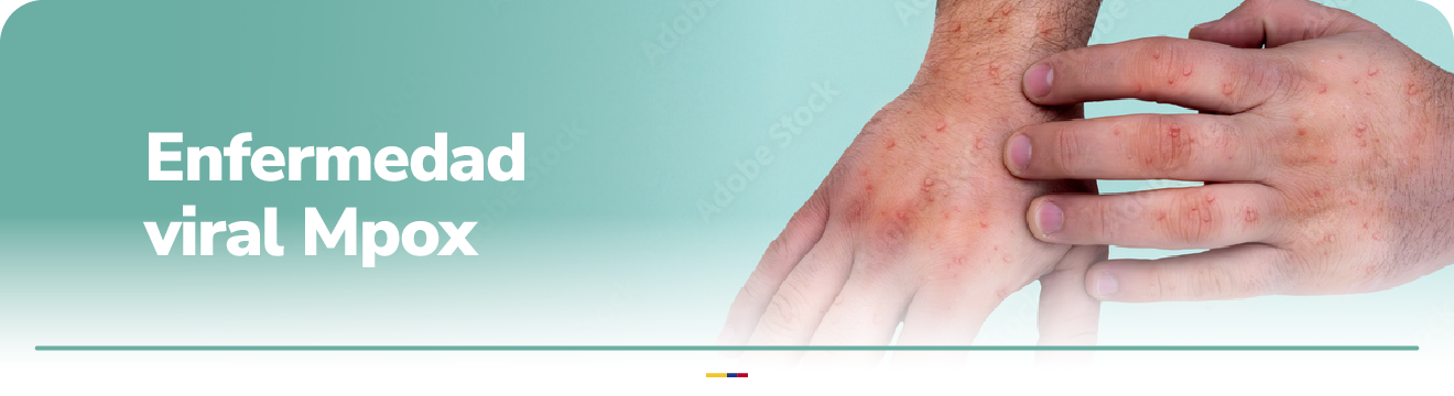 manos con eridas referentes a la viruela mpox